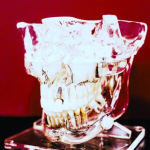 Verborgene Krankheitsursachen durch tote Zähne - spirituelle Zahnheilkunde für ganzheitliche Gesundheit