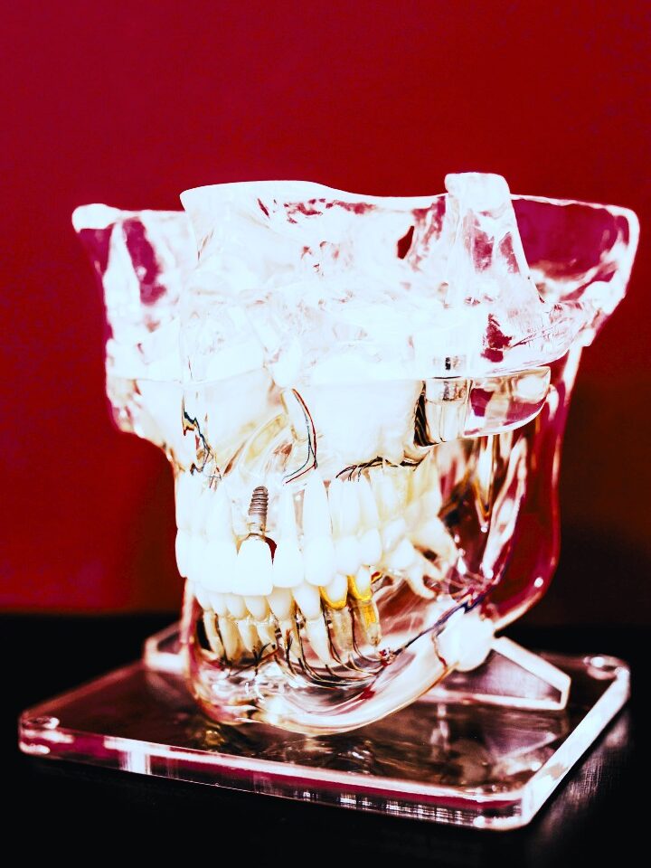 Verborgene Krankheitsursachen durch tote Zähne - spirituelle Zahnheilkunde für ganzheitliche Gesundheit